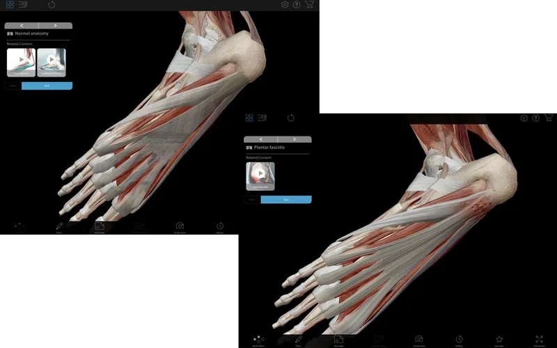 visible-body-muscle-premium2 Visible Body Muscle Premium – Phần mềm giải phẫu 3D cho ngành y